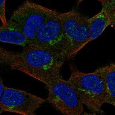 Immunocytochemistry/ Immunofluorescence: APBA2 Antibody [NBP3-17801]