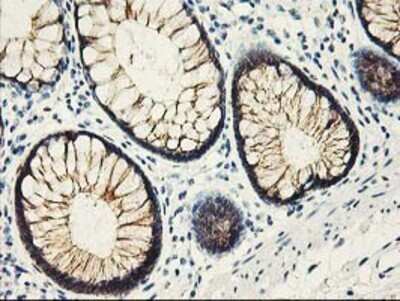 Immunohistochemistry: APBB3 Antibody (OTI5G3) - Azide and BSA Free [NBP2-71585]