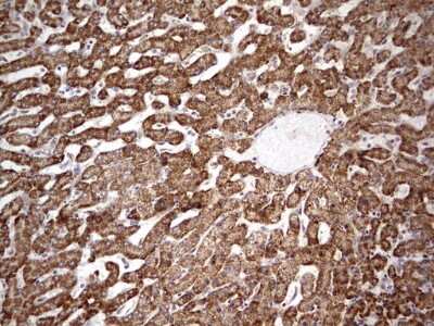 Immunohistochemistry: APC Antibody (OTI2B8) [NBP2-46529]