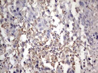 Immunohistochemistry: APC Antibody (OTI2B8) [NBP2-46529]