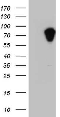 Western Blot: APC Antibody (OTI2B8) [NBP2-46529]