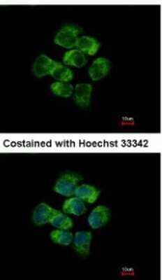Immunocytochemistry/ Immunofluorescence: APC Antibody [NBP2-15422]