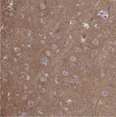 Immunohistochemistry-Paraffin: APC Antibody [NBP1-84994]