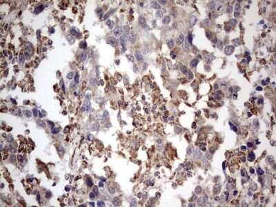 Immunohistochemistry: APC Antibody (OTI2B8) - Azide and BSA Free [NBP2-70183]