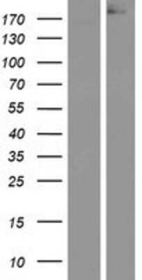 Western Blot: APC Overexpression Lysate [NBP2-09451]