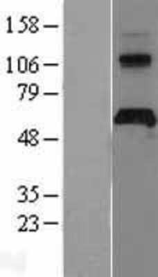 Western Blot: APCDD1 Overexpression Lysate [NBL1-07594]