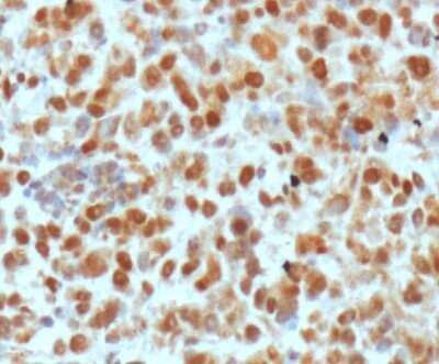 Immunohistochemistry: APE Antibody (13B8E5C2) - Azide and BSA Free [NBP2-80578]