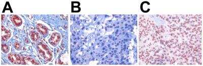 Immunohistochemistry: APE Antibody (13B8E5C2) - BSA Free [NB100-116]