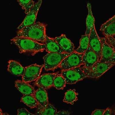 Immunocytochemistry/ Immunofluorescence: APE Antibody (CPTC-APEX1-2) - Azide and BSA Free [NBP3-08370]