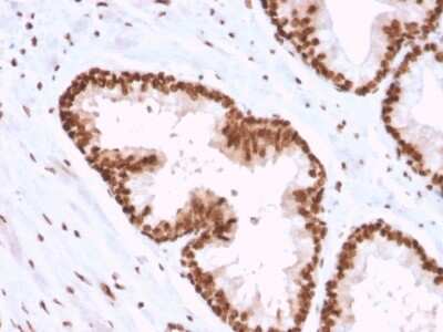 Immunohistochemistry-Paraffin: APE Antibody (CPTC-APEX1-2) [NBP3-07864]