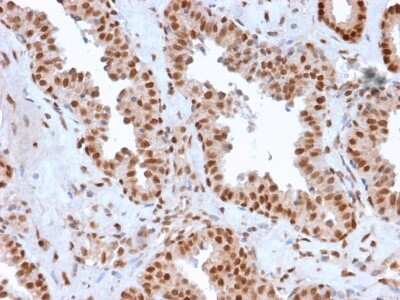 Immunohistochemistry-Paraffin: APE Antibody (CPTC-APEX1-2) [NBP3-07864]