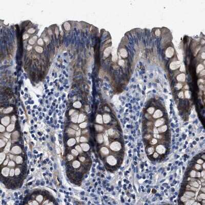 Immunohistochemistry-Paraffin: APEG1 Antibody [NBP1-90134]
