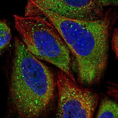 Immunocytochemistry/ Immunofluorescence: APEH Antibody [NBP1-85332]