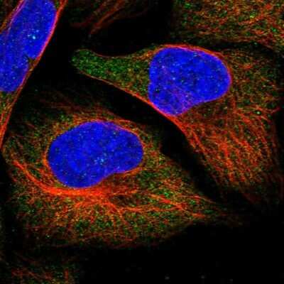 Immunocytochemistry/ Immunofluorescence: APEH Antibody [NBP1-85333]
