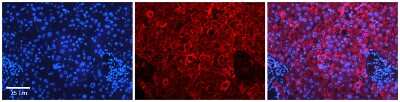 Immunohistochemistry: APEH Antibody [NBP1-54954]