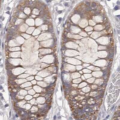 Immunohistochemistry-Paraffin: APEH Antibody [NBP1-85332]