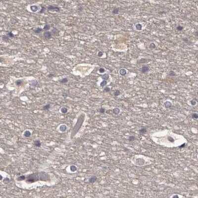 Immunohistochemistry-Paraffin: APEH Antibody [NBP1-85332]