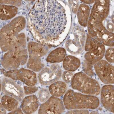 Immunohistochemistry-Paraffin: APEH Antibody [NBP1-85333]
