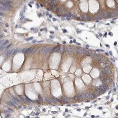 Immunohistochemistry-Paraffin: APEH Antibody [NBP1-85333]
