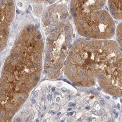 Immunohistochemistry-Paraffin: APEH Antibody [NBP1-85333]
