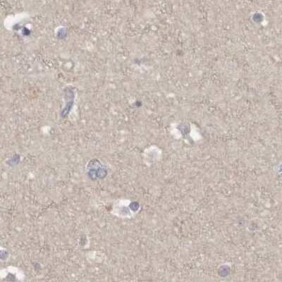 Immunohistochemistry-Paraffin: APEH Antibody [NBP1-85333]
