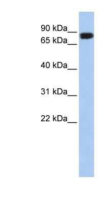 Western Blot: APEH Antibody [NBP1-54954]