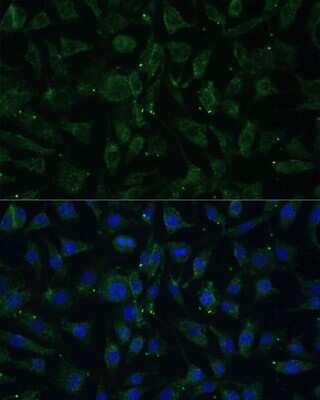 Immunocytochemistry/ Immunofluorescence: APH1A Antibody - Azide and BSA Free [NBP2-92623]