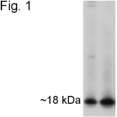 Western Blot: APH1A Antibody [NB100-74360]
