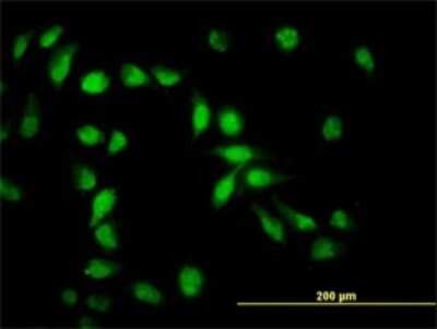Immunocytochemistry/ Immunofluorescence: API5 Antibody (1C2) [H00008539-M01]