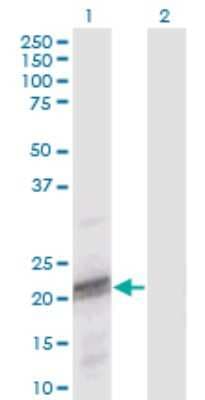 Western Blot: ODAM Antibody (2F8) [H00054959-M02]