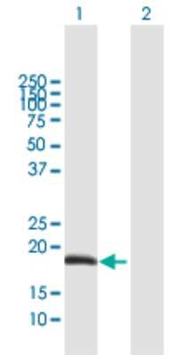 Western Blot: ODAM Antibody [H00054959-B01P]