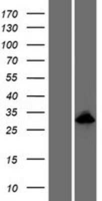 Western Blot: ODAM Overexpression Lysate [NBP2-06895]