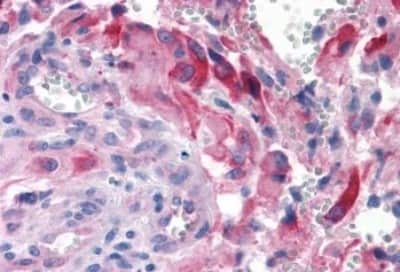 Immunohistochemistry-Paraffin: APJ/Apelin receptor Antibody [NBP3-14541]