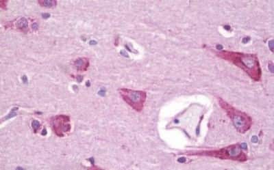 Immunohistochemistry-Paraffin: APJ/Apelin receptor Antibody [NBP3-14541]