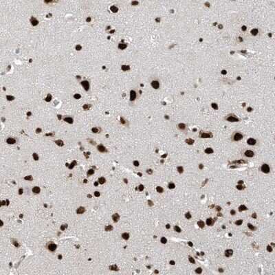 Immunohistochemistry-Paraffin: APLF Antibody [NBP2-38212]