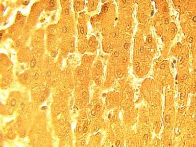 Immunohistochemistry: APM2 Antibody - C-terminus [NBP3-11922]
