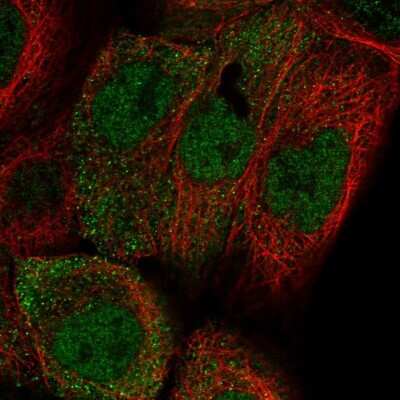 Immunocytochemistry/ Immunofluorescence: APM2 Antibody [NBP2-30736]