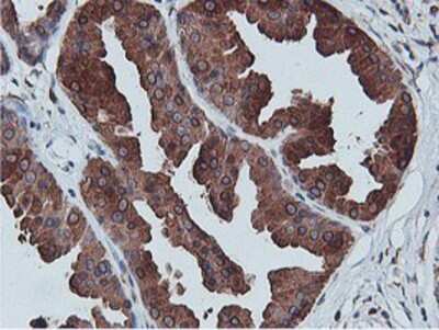 Immunohistochemistry-Paraffin: APMAP Antibody (OTI4F6) [NBP2-01716]