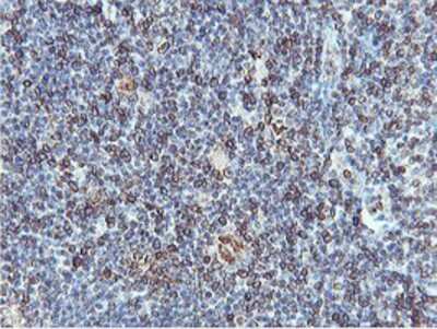 Immunohistochemistry-Paraffin: APMAP Antibody (OTI4F6) [NBP2-01716]