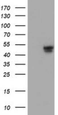 Western Blot: APMAP Antibody (OTI4F6) [NBP2-01716]