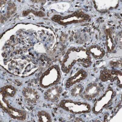 Immunohistochemistry-Paraffin: APMAP Antibody [NBP1-89927]