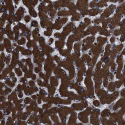 Immunohistochemistry-Paraffin: APMAP Antibody [NBP1-89927]