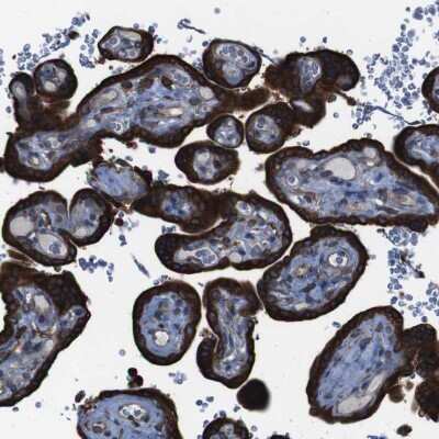 Immunohistochemistry-Paraffin: APMAP Antibody [NBP1-89927]