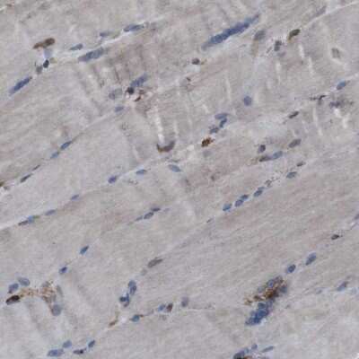 Immunohistochemistry-Paraffin: APMAP Antibody [NBP1-89927]