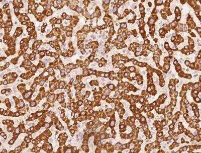 Immunohistochemistry-Paraffin: APMAP Antibody [NBP3-12576]
