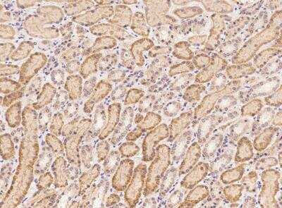Immunohistochemistry-Paraffin: APMAP Antibody [NBP3-12696]