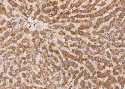 Immunohistochemistry-Paraffin: APMAP Antibody [NBP3-12696]