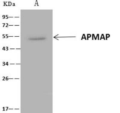 Immunoprecipitation: APMAP Antibody [NBP3-12696]