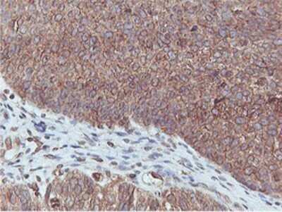 Immunohistochemistry: APMAP Antibody (OTI4F6) - Azide and BSA Free [NBP2-72080]