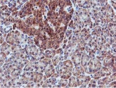 Immunohistochemistry: APMAP Antibody (OTI4F6) - Azide and BSA Free [NBP2-72080]